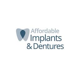 affordableimplant